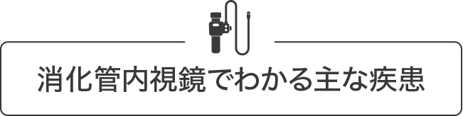 消化管内視鏡でわかる主な疾患